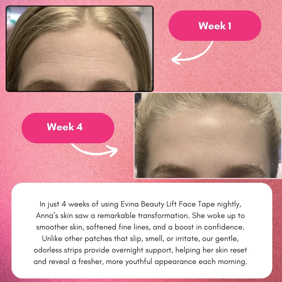 Evina Beauty Lift Face Tape