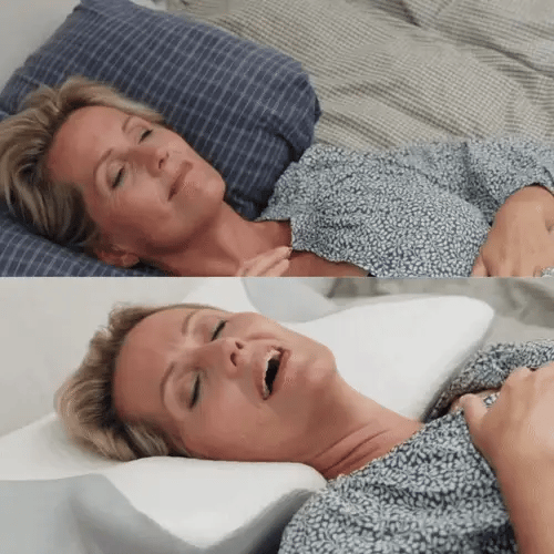 SleepMed™ Nakkeavlastning